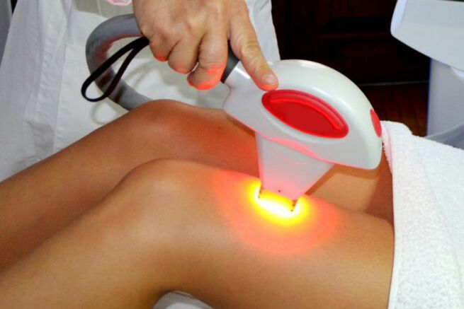 Penyingkiran rambut rambut laser